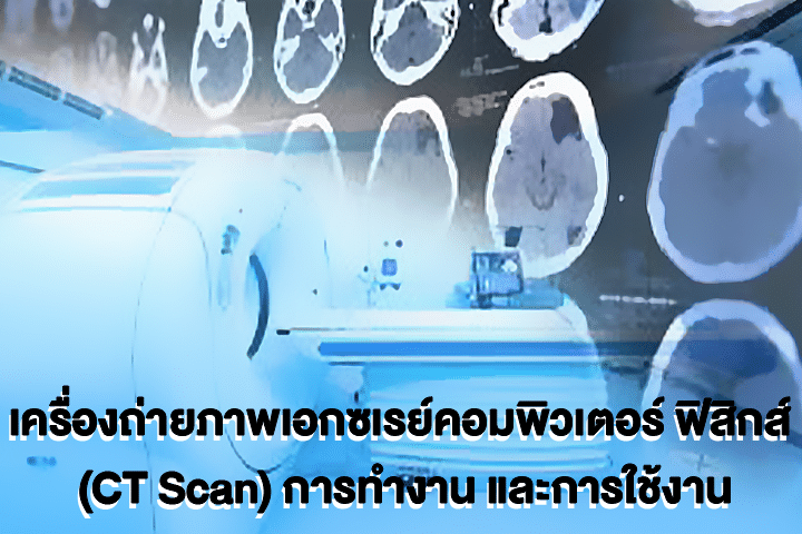 เครื่องถ่ายภาพเอกซเรย์คอมพิวเตอร์ ฟิสิกส์ (CT Scan) การทำงาน และการใช้งาน