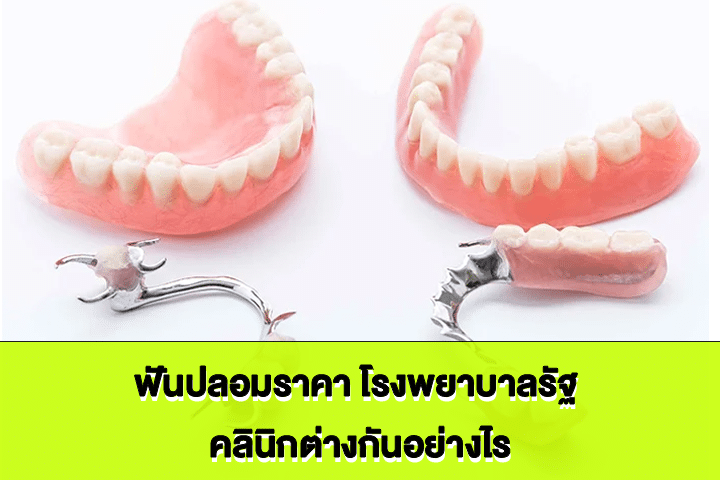 ฟันปลอมราคา โรงพยาบาลรัฐ คลินิกต่างกันอย่างไร