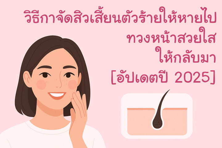 วิธีกำจัดสิวเสี้ยนตัวร้ายให้หายไป ทวงหน้าสวยใสให้กลับมา [อัปเดตปี 2025]