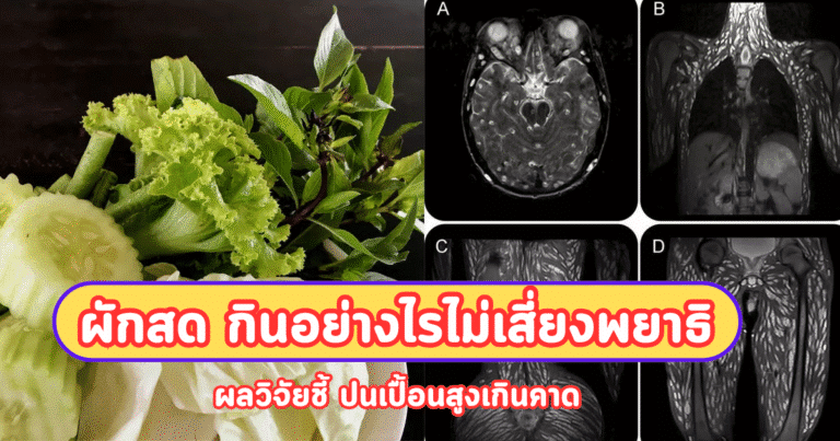 ผักสด กินอย่างไรไม่เสี่ยงพยาธิ ผลวิจัยชี้ ปนเปื้อนสูงเกินคาด