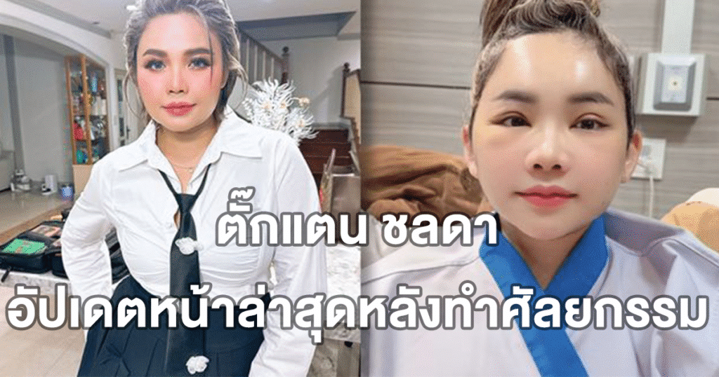 ตั๊กแตน ชลดา อัปเดตหน้าล่าสุดหลังทำศัลยกรรม เวอร์ชันใหม่ดูสวยเรียวขึ้น