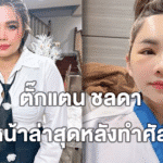 ตั๊กแตน ชลดา อัปเดตหน้าล่าสุดหลังทำศัลยกรรม เวอร์ชันใหม่ดูสวยเรียวขึ้น